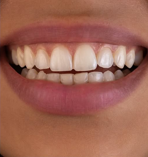 Before treatment
