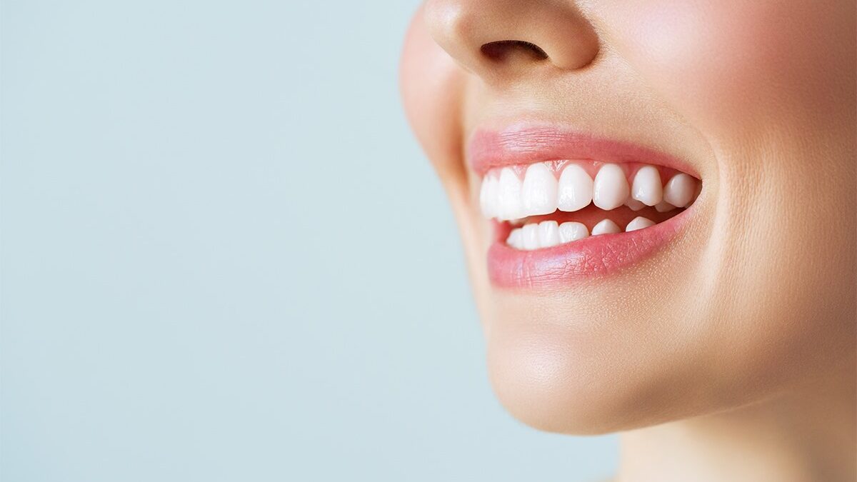 Professional teeth whitening results